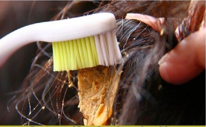 saça yapışan sakız nasıl çıkarılır
